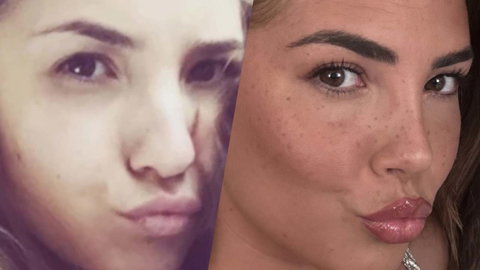 Martina De Ioannon svela cosa si è rifatta, perché e quante volte preview