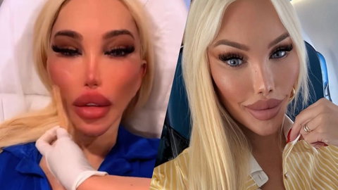 Jessica Alves, il nuovo volto e gli ultimi interventi: “Ho speso oltre 1 milione di sterline per 100 operazioni” preview