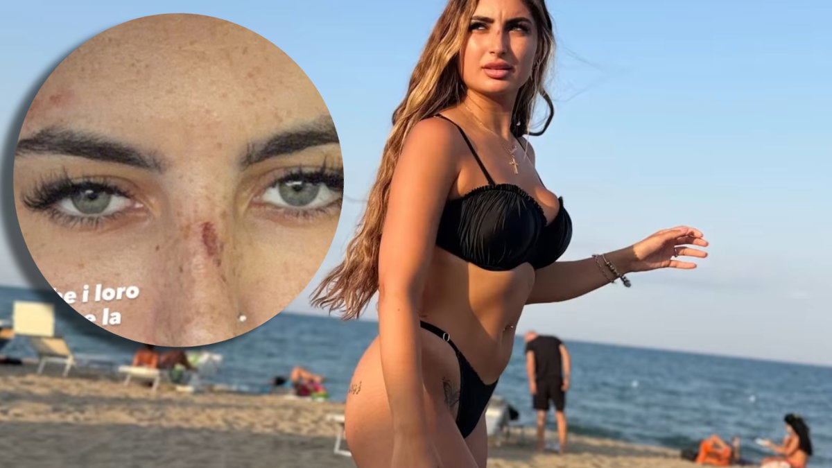 Sabrina Soussi di Temptation Island è stata aggredita da degli hater: graffi sul volto article-post