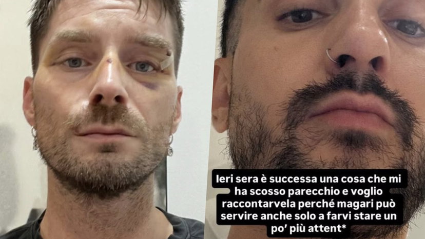 Luca Burini e Daniele Lorusso aggrediti e derubati a Milano: i loro racconti preview