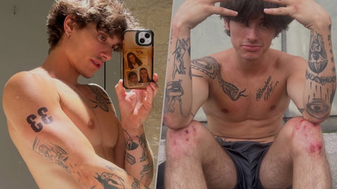Pietro Checchi mostra le ferite dopo il combattimento con Raffaele Del Piano a Physical Italia preview