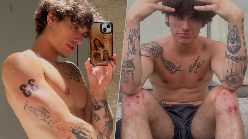 Pietro Checchi mostra le ferite dopo il combattimento con Raffaele Del Piano a Physical Italia preview
