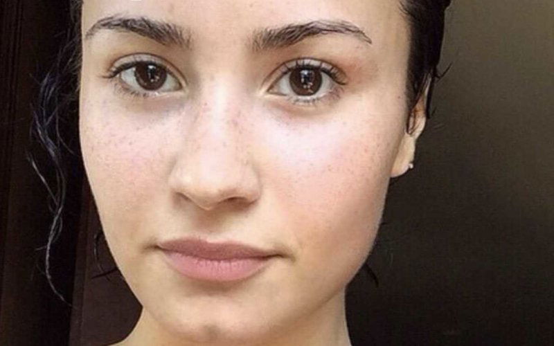 demi lovato ospedale vita amici condizioni