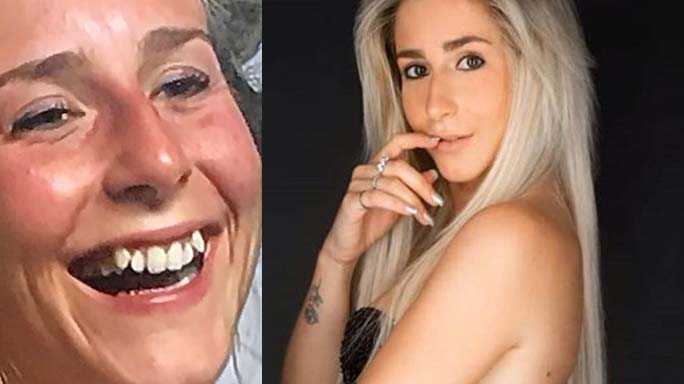 lara temptation island denti apparecchio