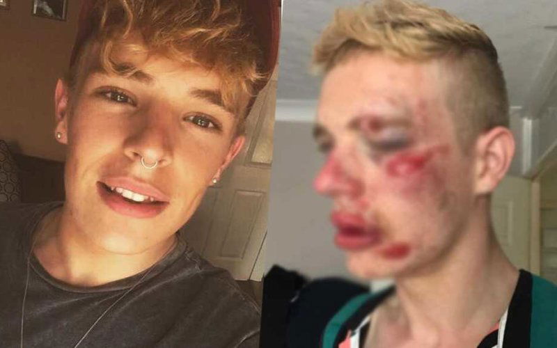 ryan williams gay omofobia notizie