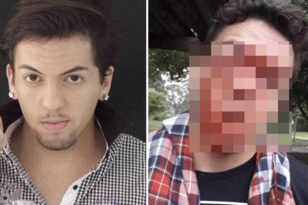 Omofobia Brasile aggressione gay ragazzo
