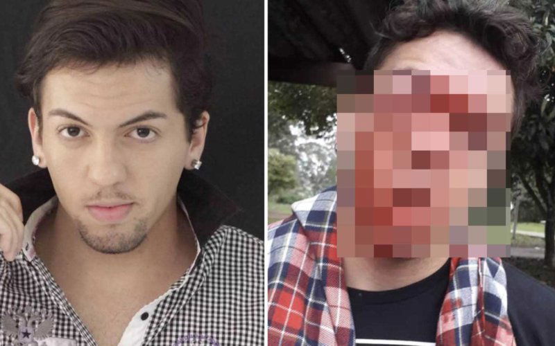 Omofobia Brasile aggressione gay ragazzo