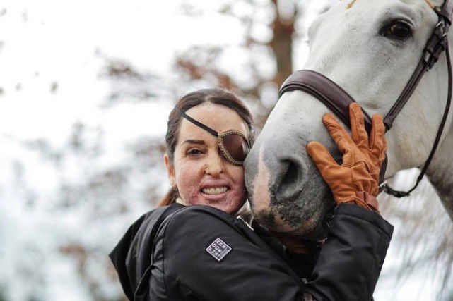 Gessica Notaro a Ballando con le Stelle 2018: la Miss sfregiata dall’ex nello show di Milly Carlucci preview