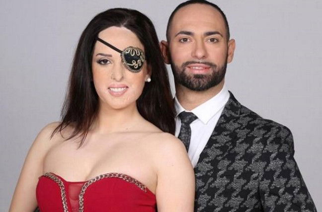 Gessica Notaro a Ballando con le Stelle 2018: “Lancio una sfida alle vittime di violenza, mi trovo bella!” preview