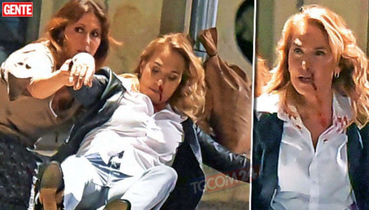 Barbara d’Urso sanguinante e priva di sensi: le immagini esclusive sul set de La Dottoressa Giò article-post