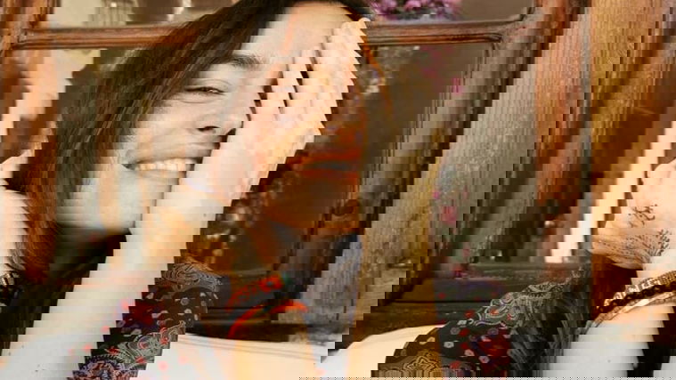 Kasia Smutniak mostra la sua vitiligine: “Bisogna amare i propri difetti!” preview