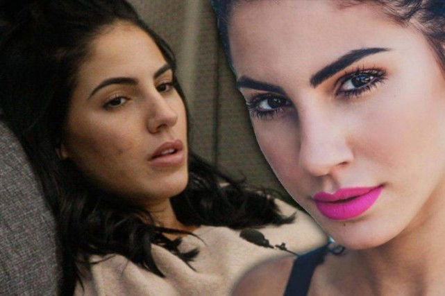 Giulia De Lellis: “Ho una pelle mostruosa!”, la cura farmacologica contro l’acne preview