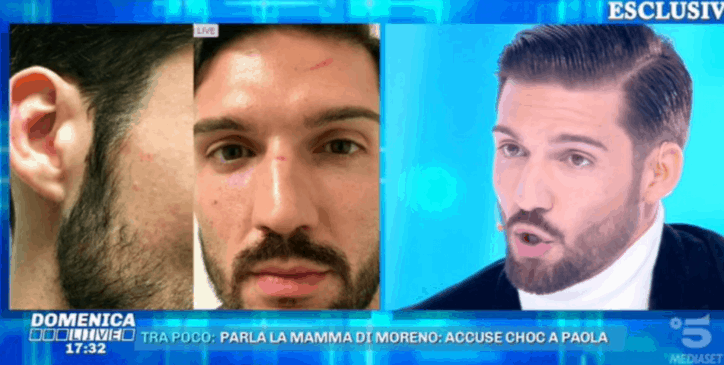 Moreno Merlo: “Occhio nero di Paola Caruso? Follia!”, lei si sottopone alla macchina della verità preview