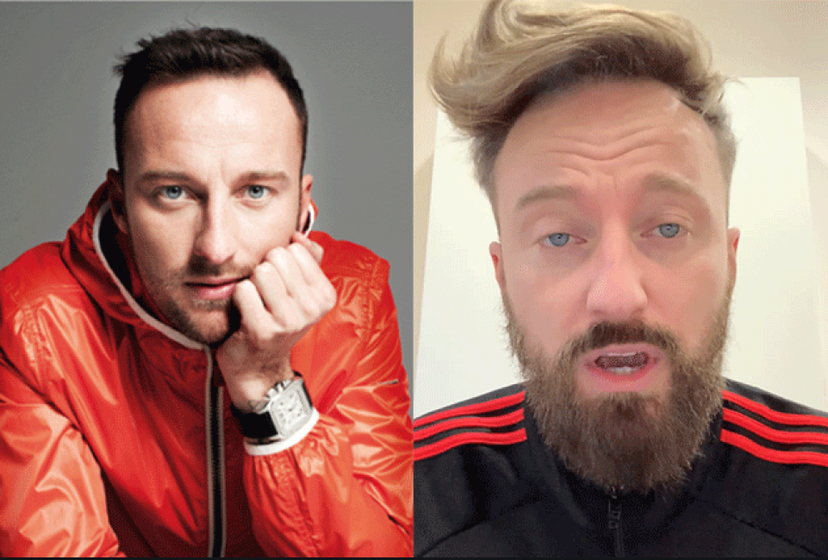 Francesco Facchinetti, capelli: “trapianto non chirurgico”, ecco cosa ha fatto preview