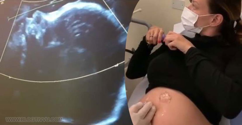 Silvia Provvedi presto mamma: ecografia sui social, l’emozionante VIDEO preview