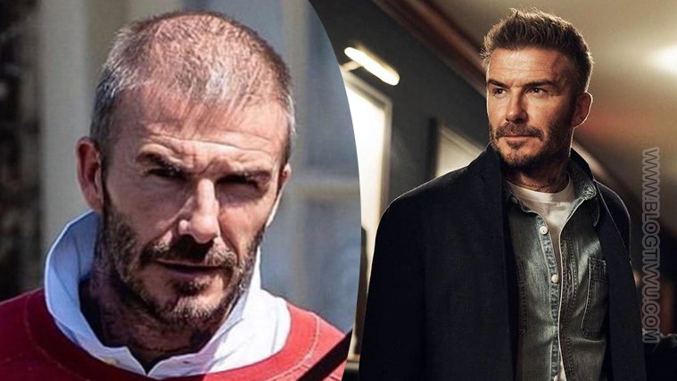 David Beckham è pelato? La fotografia choc dove non c’è traccia dei suoi capelli preview