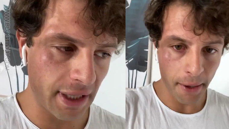 Iconize vittima di omofobia, aggressione e pugni in faccia: “Fr*cio!”, il drammatico accaduto (VIDEO) preview