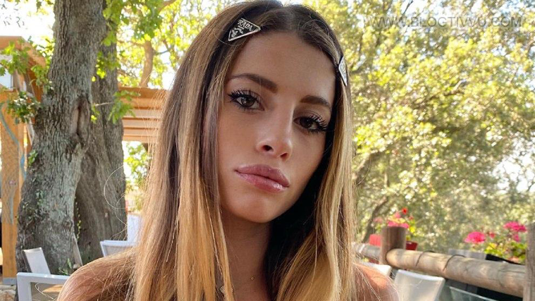 Chiara Nasti si è rifatta il lato B? Il chirurgo estetico la “smaschera”: “Mi sono rotta le pall*!” preview