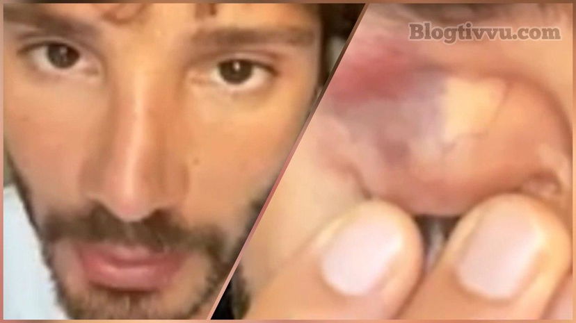 Stefano De Martino, occhio nero prima di Made in Sud: cosa è successo? (VIDEO) preview