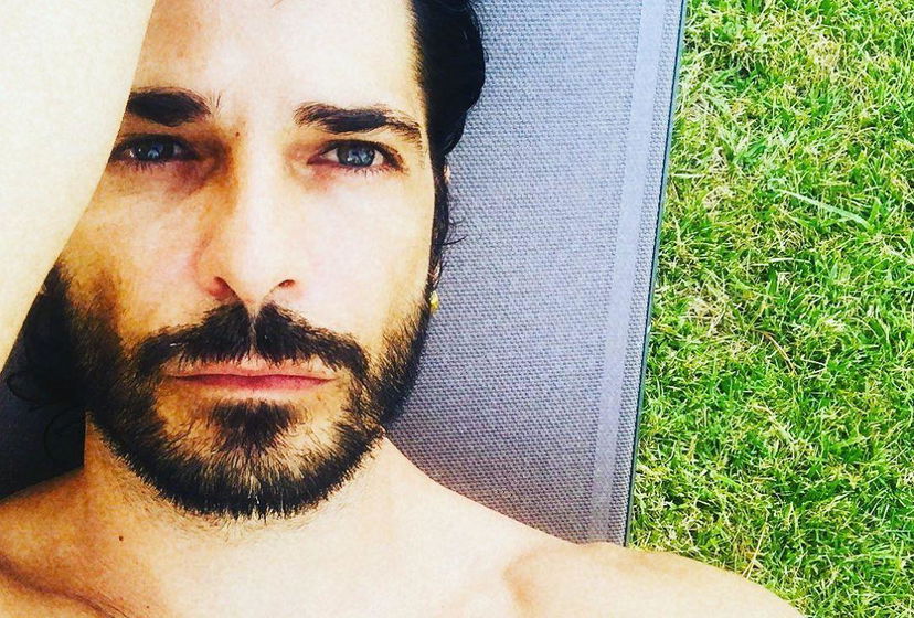 Marco Bocci, l’herpes al cervello scoperto dopo un incidente: “Rabbia e voglia di vita” preview