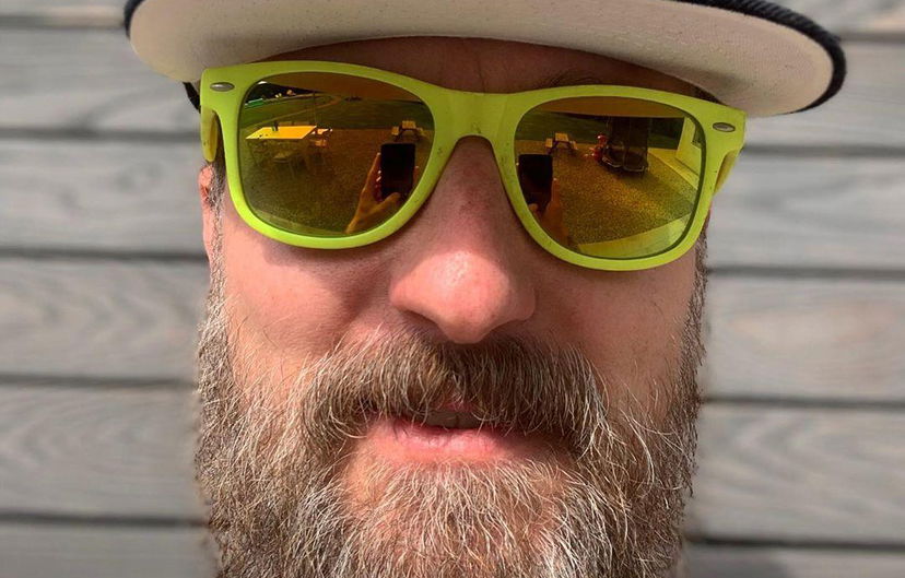 “Vip spilorcio, chiedi lo sconto: mi fai schifo!”: Francesco Facchinetti, lo sfogo choc preview