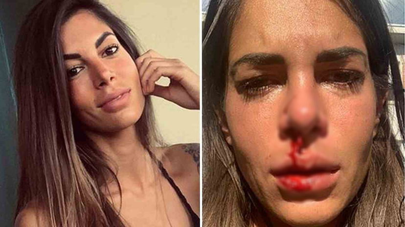 “Mi scuso per le foto”, Giada Giovanelli dopo l’aggressione del padre chiude il profilo Instagram preview