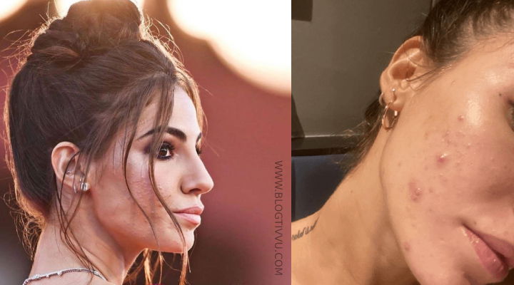 Giulia De Lellis “stroncata” su Rai1 per l’acne a Venezia: “Non passa un bel messaggio” preview