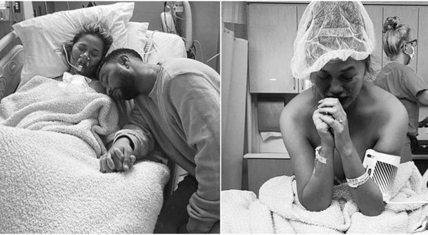 Aborto spontaneo per Chrissy Teigen