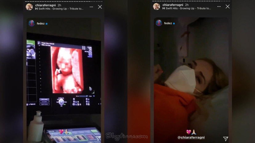 Chiara Ferragni, il video dell’ecografia: svelato il viso della sua bambina preview
