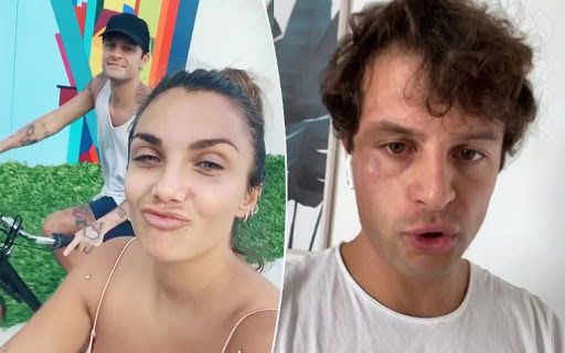 Quel like di Elettra Lamborghini contro Iconize: finta aggressione omofoba smascherata dalla d’Urso preview