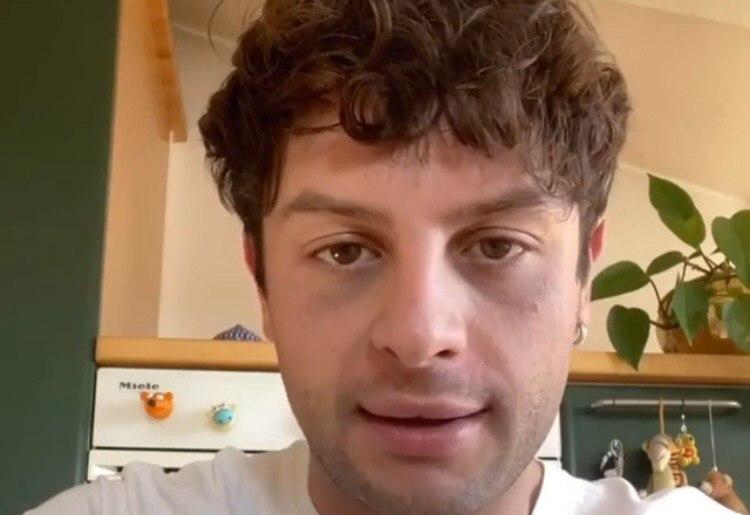 Iconize ammette la farsa e chiede scusa “momento buio, nessun surgelato: autolesionismo” – VIDEO preview