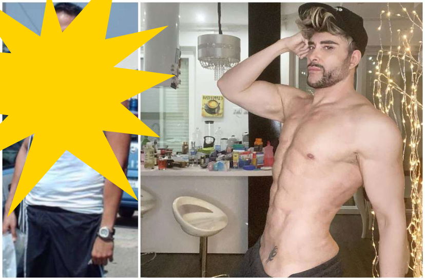 Giacomo Urtis rifatto, PRIMA e DOPO choc: ecco tutti gli interventi chirurgici (FOTO) preview