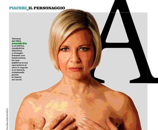 Antonella Elia ha avuto un tumore al seno