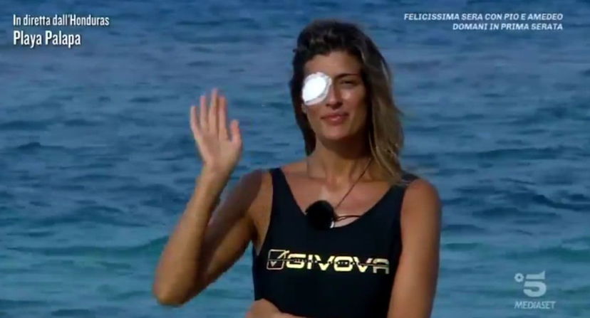 Perché Elisa Isoardi ha l’occhio bendato? Incidente con il fuoco, ecco cosa è successo preview