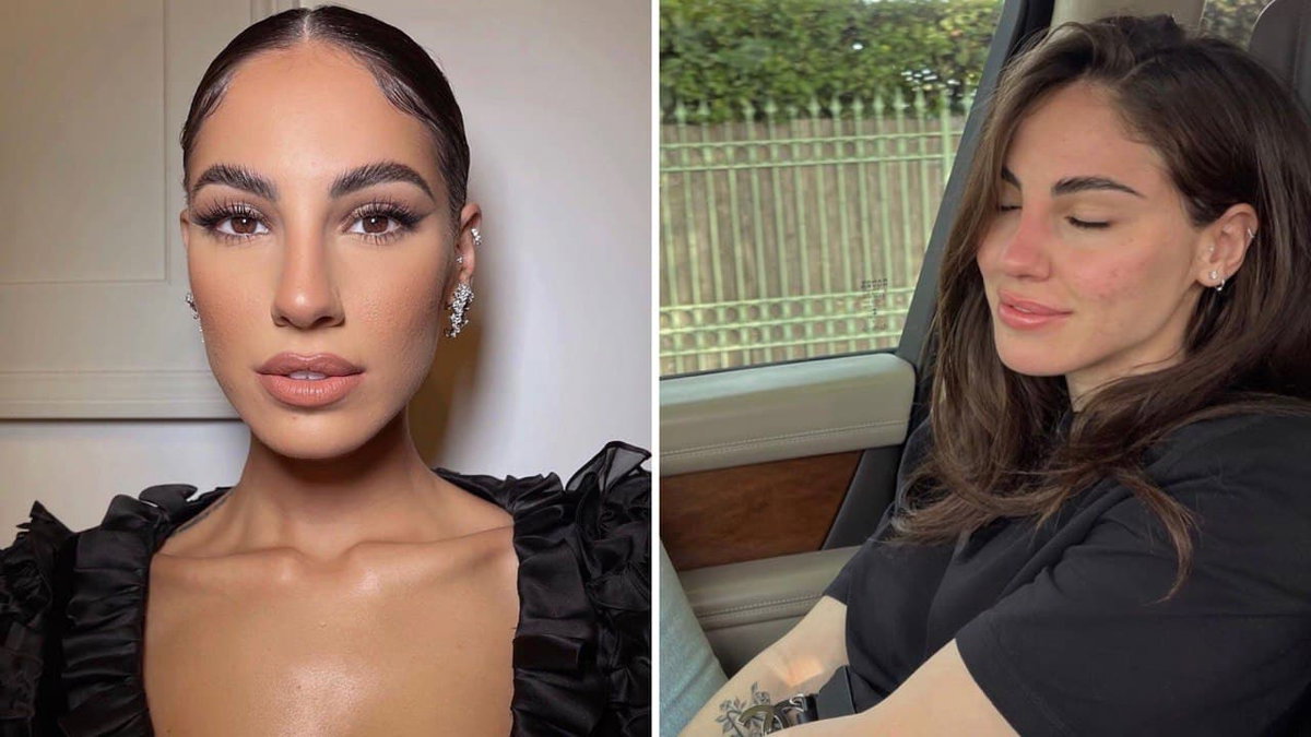 Giulia De Lellis, ‘lettera’ alla sua pelle “instancabile stronz*”: l’acne, il calvario, l’amore di Carlo Beretta article-post