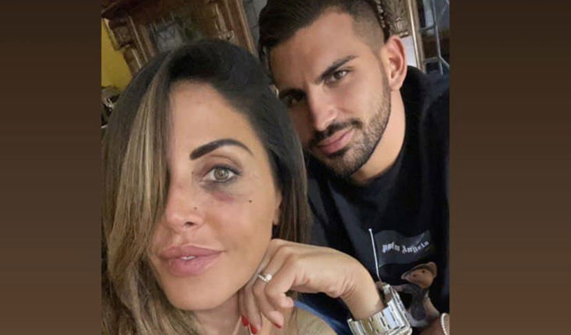 Guendalina Tavassi, come sta dopo l’aggressione? Il fidanzato Federico Perna al suo fianco preview