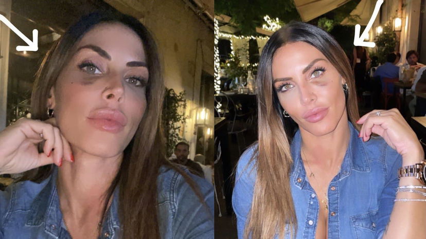Guendalina Tavassi e l’occhio nero, hater non crede all’aggressione: lei mostra referto dell’ospedale preview