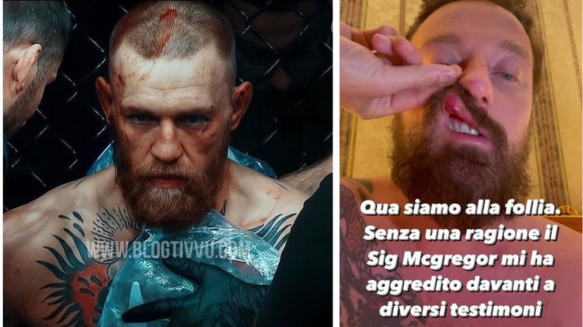 Francesco Facchinetti aggredito da Conor McGregor: “Mi ha spaccato il naso, è una persona pericolosa” – VIDEO preview