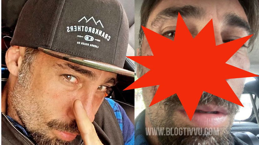 Vittorio Brumotti aggredito, foto choc: l’inviato di Striscia la Notizia ridotto male a Foggia preview