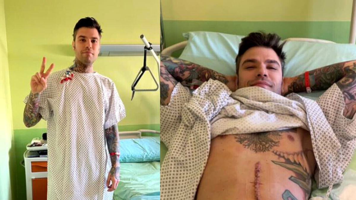 Fedez e il tumore al pancreas, il medico che lo ha operato svela un retroscena: “Avevamo fatto un patto, ma lui…” article-post