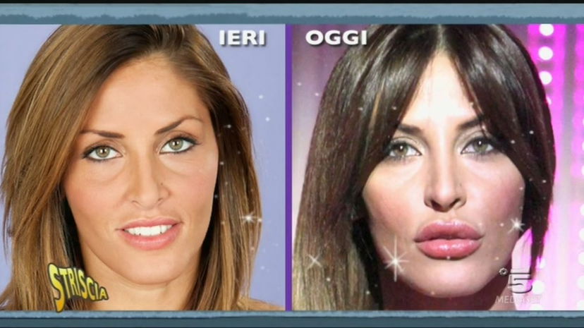 Guendalina Tavassi è rifatta? Ecco le parti del corpo che ha modificato: le foto prima della chirurgia estetica preview