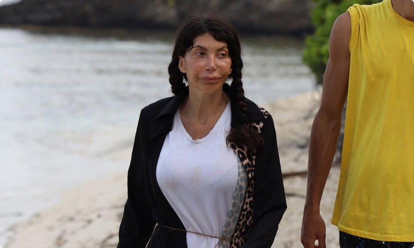 Le “accuse” di una dottoressa: “All’Isola dei Famosi è arrivato un chirurgo estetico con il botulino per rifarle tutte!” – VIDEO preview