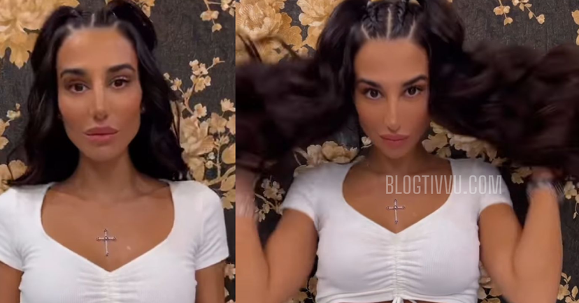 Patrizia Bonetti mostra i segni dell’ustione dopo l’Isola dei Famosi? – FOTO preview