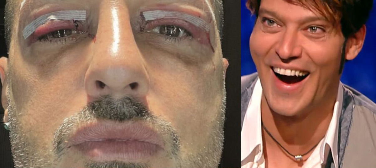 Fabrizio Corona rifatto punge Gabriel Garko: “Ecco chi sembra” article-post