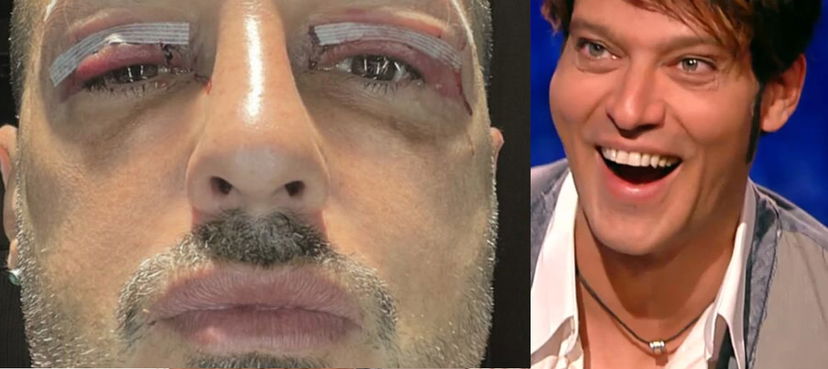 Fabrizio Corona rifatto punge Gabriel Garko: “Ecco chi sembra” preview