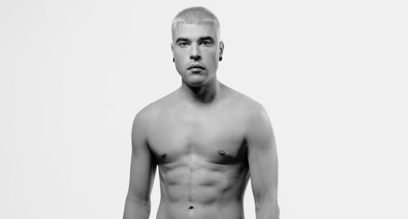 Sanremo 2023, Fedez svela se sarà accanto a Chiara Ferragni e parla del tumore: “Ecco come sto oggi” preview