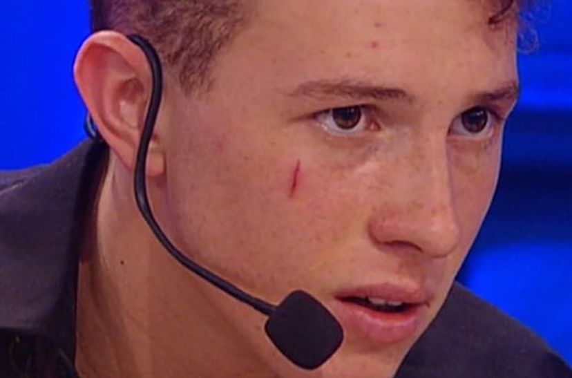 Perché Wax del serale di Amici 22 ha una cicatrice sulla faccia? Taglio o tatuaggio: ecco il motivo del misterioso segno preview