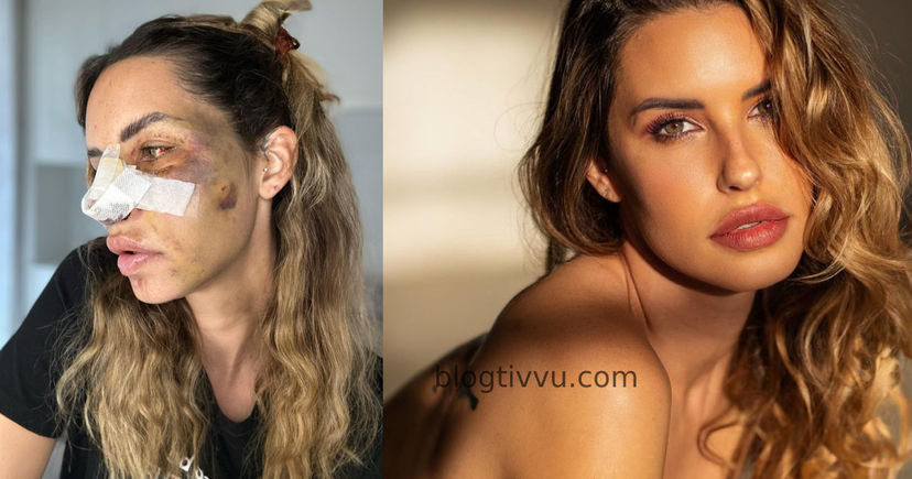 Temptation Island, Carlotta Adacher svela le dinamiche dell’incidente stradale: il toccante video social preview