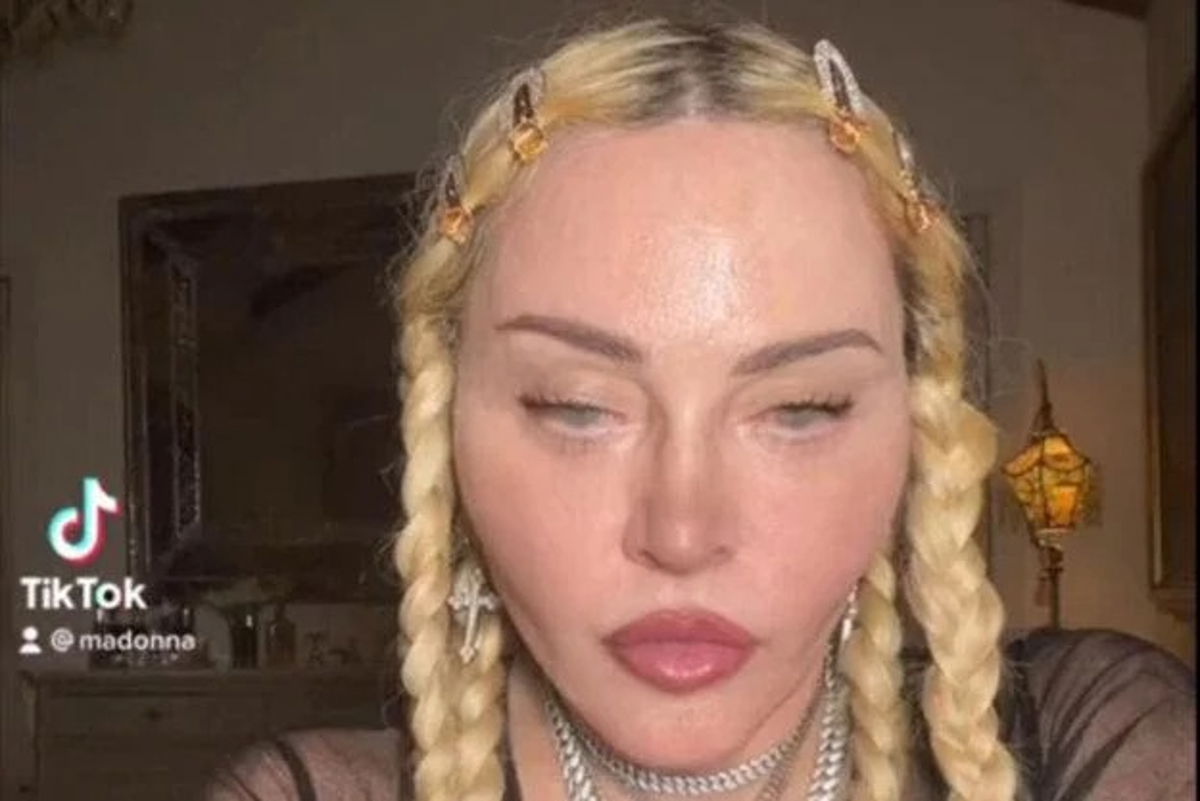 Madonna come Michael Jackson? La paura degli amici: “Ha esagerato” article-post