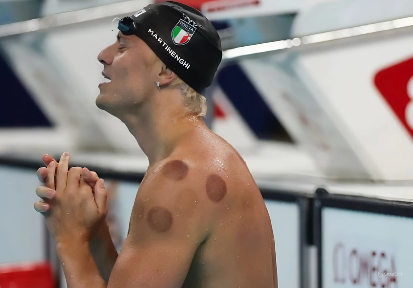 Olimpiadi 2024, cosa sono i cerchi scuri sul corpo dei nuotatori, a cosa servono e come si chiama questa terapia preview